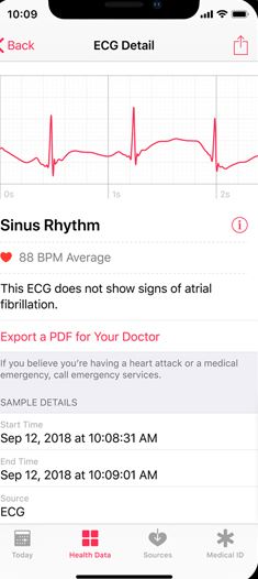 ecg on health app
